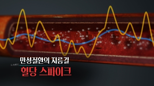 '생로병사의 비밀' 혈당 스파이크 [KBS]