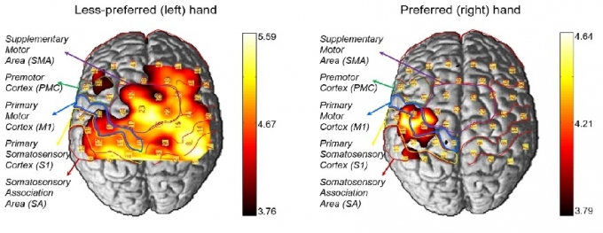 수동 촉각 자극에 따른 왼손과 오른손의 대뇌대사활성의 비대칭성을 보여주는 뇌 신호 활성화 사진. (왼쪽)동일한 수동촉각 자극에 대해 왼손은 좌우 반구 대칭성이 높아 뇌 활성화 단면이 넓은 반면, (오른쪽) 오른손은 감각운동피질의 대뇌 좌우 반구 대칭성이 낮아 뇌 활성화 단면이 좁다. [DGIST]