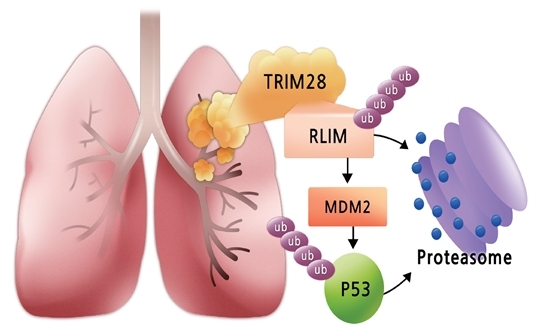 폐암 환자에서 TRIM28의 발현 양이 증가한다. RLIM 단백질 분해를 유도, RLIM의 발현 양은 줄어든다. RLIM에 의해 분해가 되는 MDM2의 단백질은 증가하고 증가한 MDM2는  대표 종양 억제 단백질인 p53을 분해, 폐암이 발생한다.  [한국연구재단]
