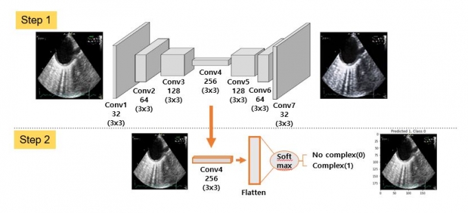 1단계는 원본을 바탕으로 출력된 이미지를 원본과 유사하게 만들기 위해 다양한 레이어로 학습이 이뤄지는 과정을 나타낸다. 2단계는 1단계의 학습을 거친 데이터를 함수를 통해 정상과 복합성 상태로 분류하는 과정이다. 연구팀은 이렇게 얻은 데이터와 의료팀의 판단 값을 비교한 결과 80% 일치하는 결과를 얻었다. [사진=한국기계연구원]